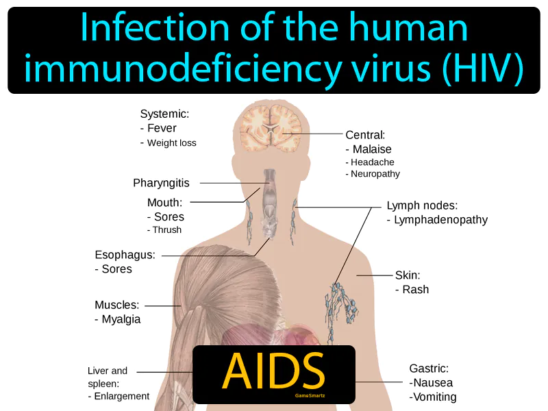 AIDS Definition