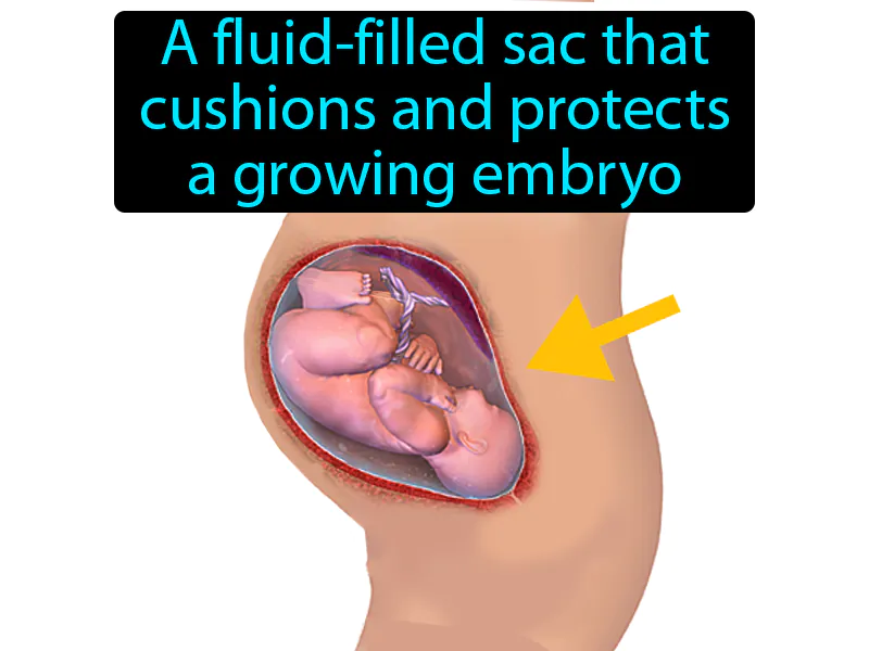 Amniotic Sac Definition - Easy to Understand | GradesUp.gg