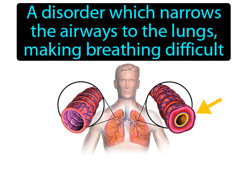 Asthma Definition - Easy to Understand | GradesUp.gg