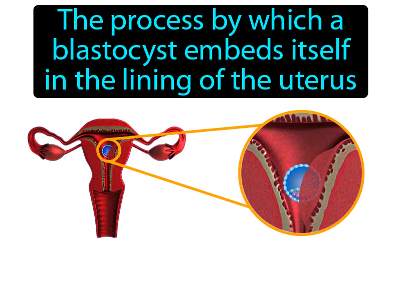 Implantation Definition