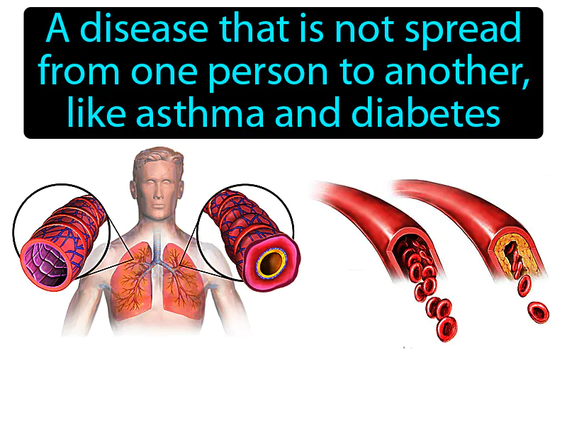 Noninfectious Disease Definition - Easy to Understand | GradesUp.gg