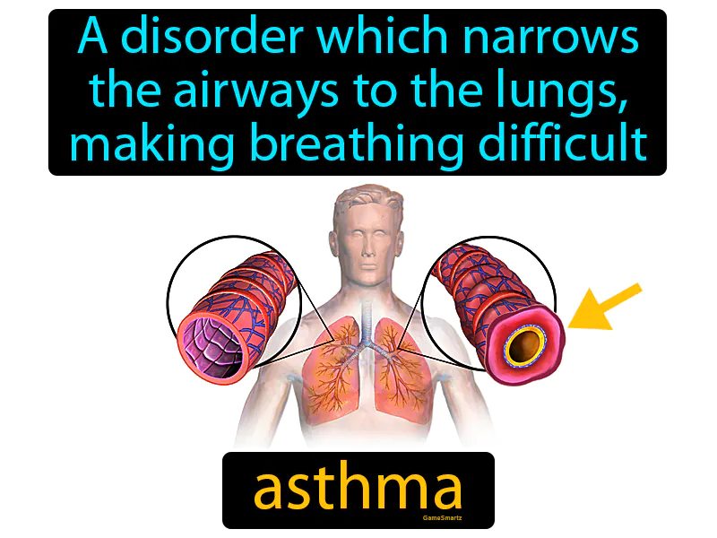 Asthma Definition - Easy to Understand | GradesUp.gg